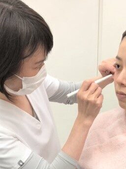 大阪市美容皮膚科シロノJクリニックのヒアルロン酸注入アセスメント風景