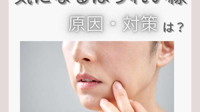 気になるほうれい線の原因・対策は？