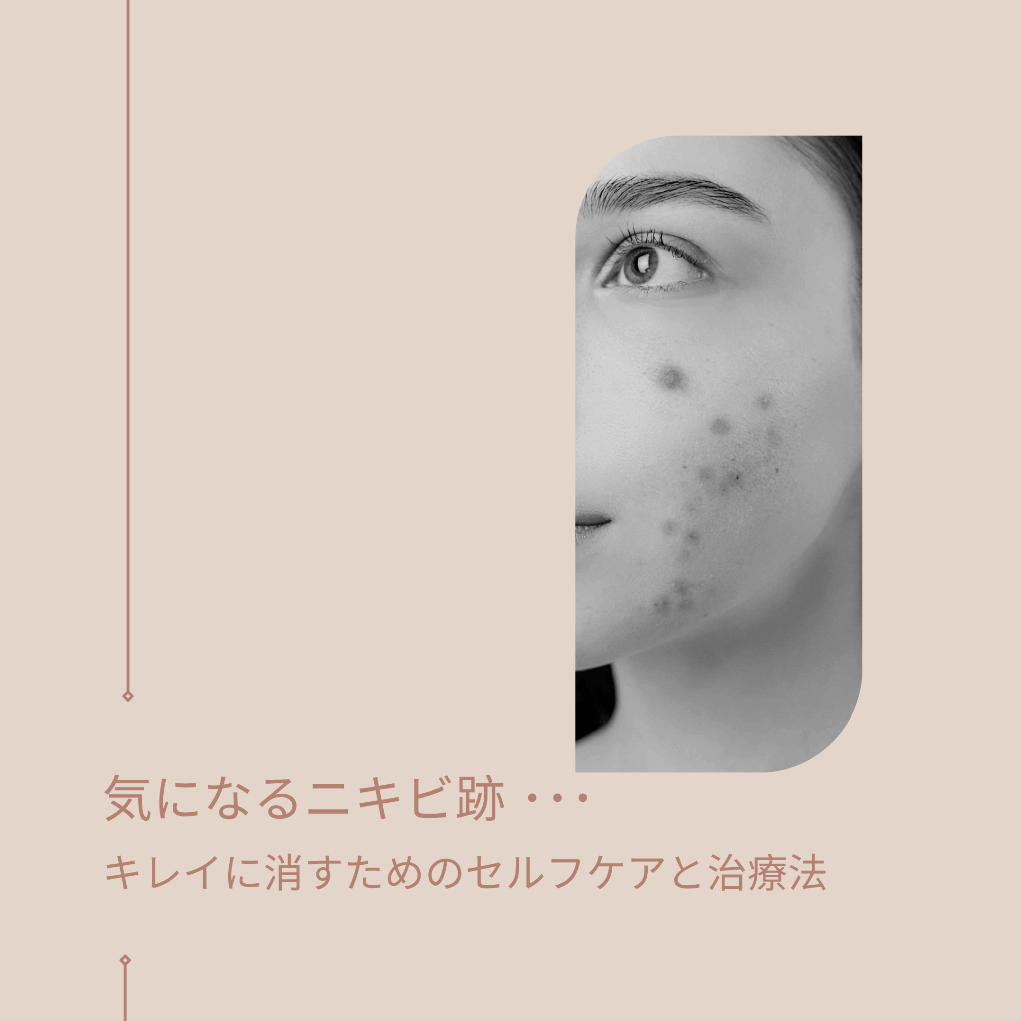 シロノJクリニック｜大阪梅田のレーザー治療専門美容皮膚科